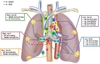 Metastatic Patterns of Mediastinal Lymph Nodes in Small-Size Non-small Cell Lung Cancer (T1b)